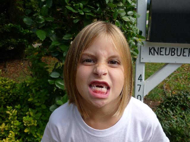 No teeth