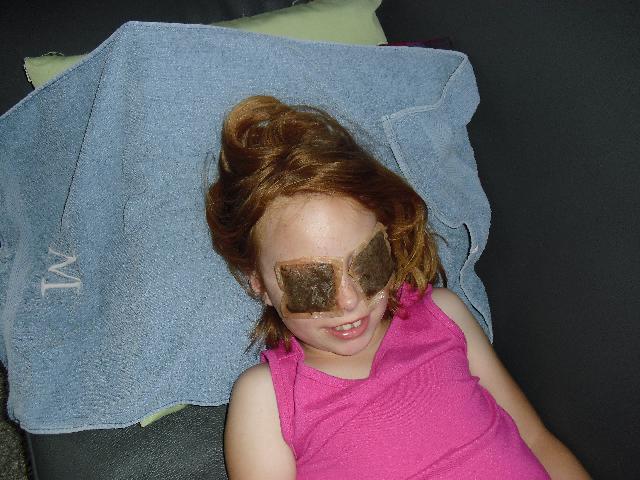 Tea bag eye treatment